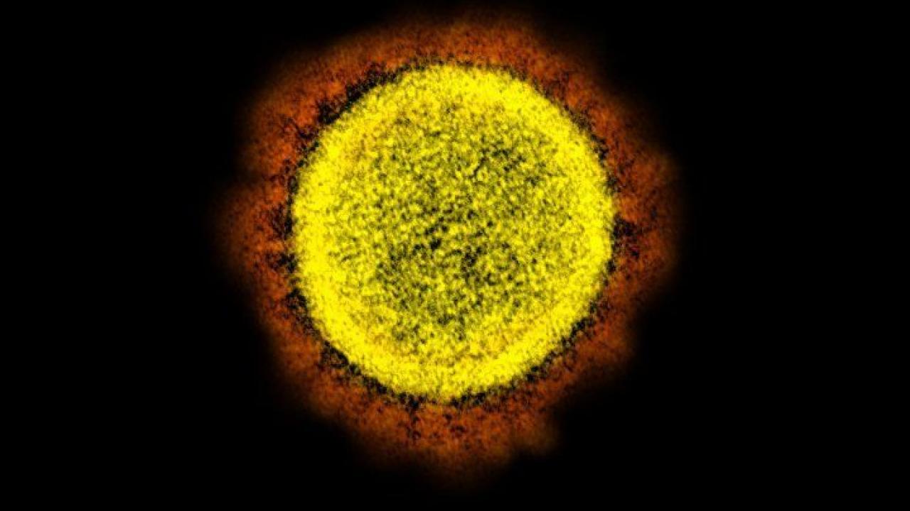 Transmission electron micrograph of the SARS-CoV-2 virus. Image credit: NIAID