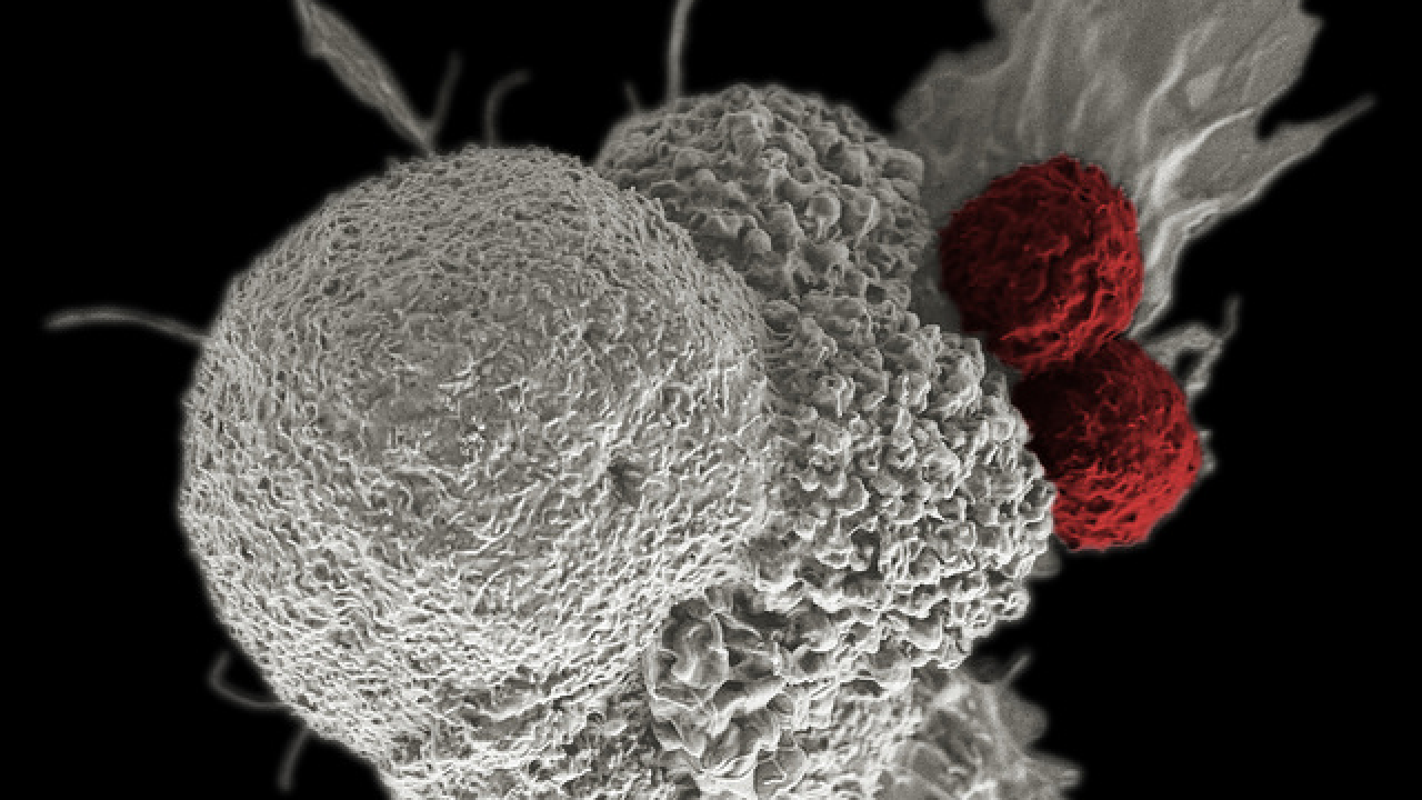 Credit: NIH Images