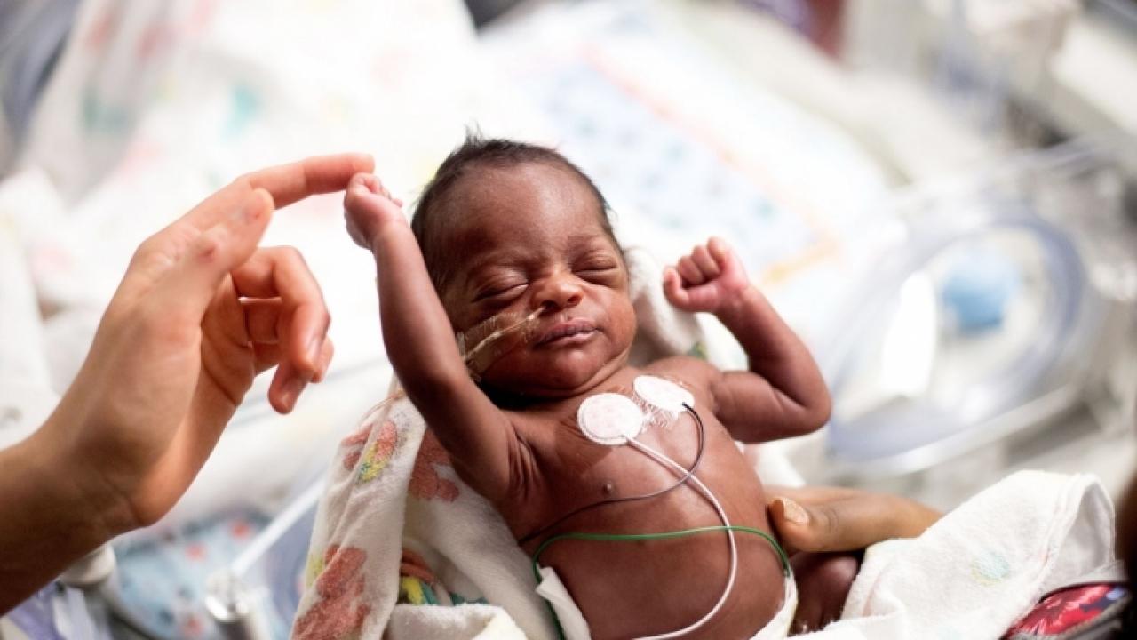 Jahkai McFarland stretches out in the neonatal intensive care unit at UCSF Benioff Children's Hospital, which ranked No. 7 for its neonatology program in the latest U.S. News Best Children's Hospitals rankings. Photo by Noah Berger