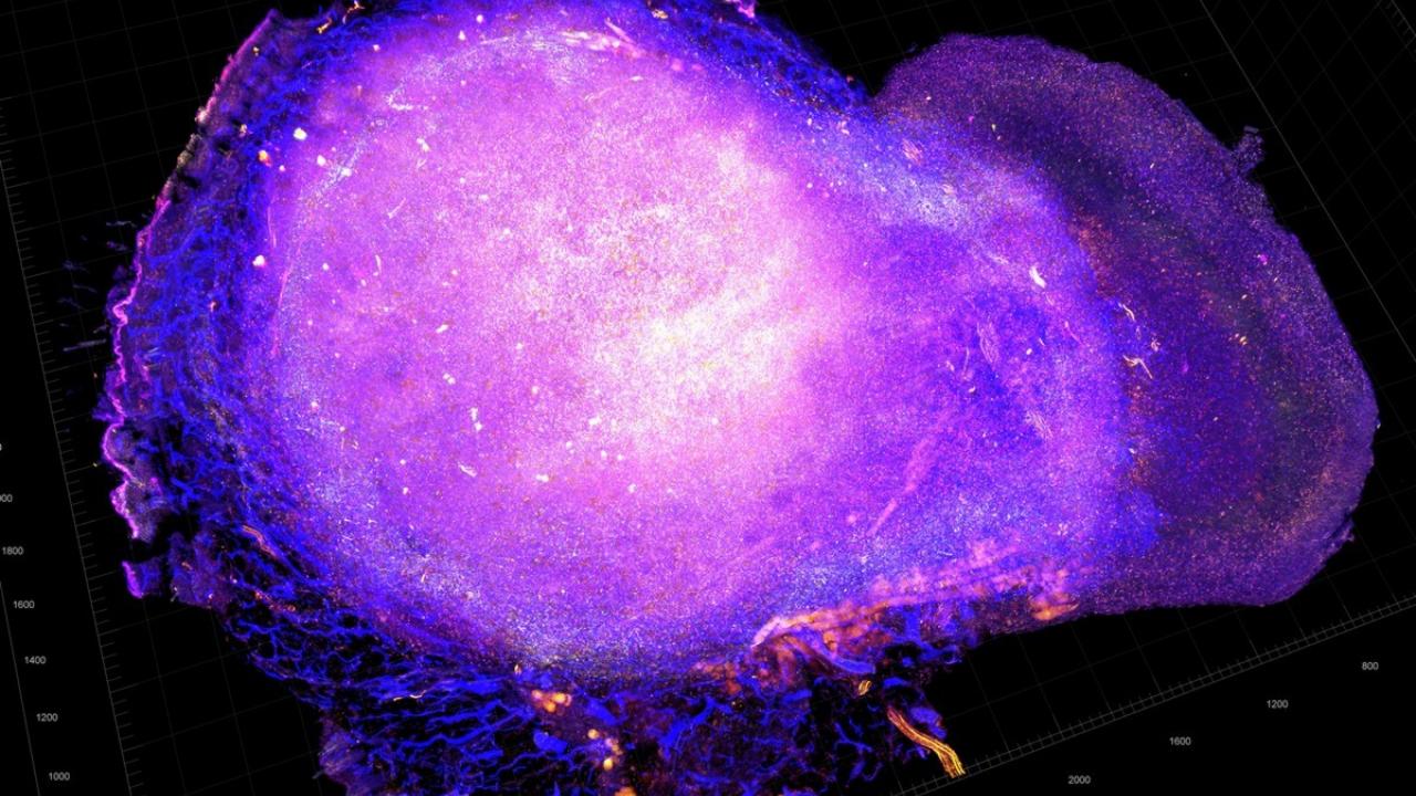 Anti-Tumor Immune Response. Image courtesy of the National Cancer Institute.