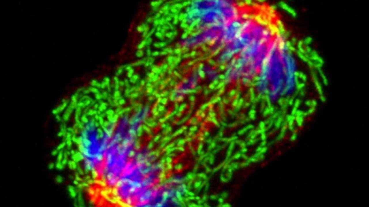 A triple-negative breast cancer cell (MDA-MB-231) in metaphase during cell division. Image courtesy the National Cancer Institute.