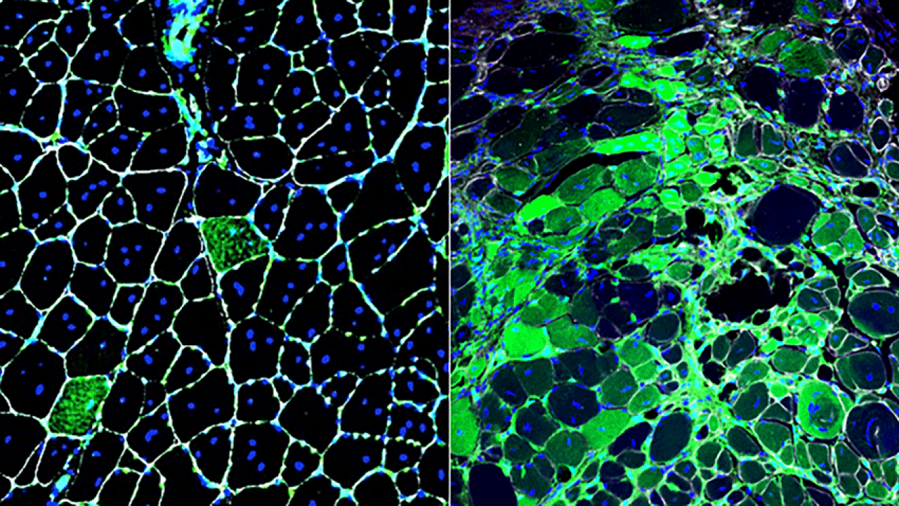 Newly discovered radiation-resistant stem cells are normally rare and inactive (left), but they take on a major role in muscle repair when regular stem cells are damaged by radiation (right). Credit: Brack lab / UCSF.