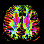 Cancer Imaging Resources Core