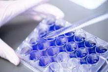 Gloved hands use a pipette to transfer liquid into a multiwell laboratory plate.