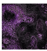 KRAS signalling pathway