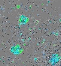 A microscope image of tumor cells where scattered clusters glow with bright green and turquoise highlights, representing the accumulation of radioactive antibodies.