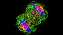 A triple-negative breast cancer cell in metaphase during cell division. Image by National Cancer Institute