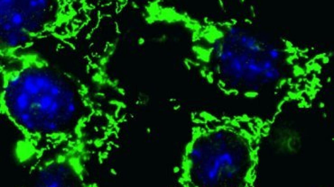 The green indicates the key protein HIGD1A that slows down the metabolism of cancer cells, allowing them to hibernate and survive longterm. These mouse embryonic cells have been programmed to overexpress the protein. Image courtesty of the Maltepe Lab.
