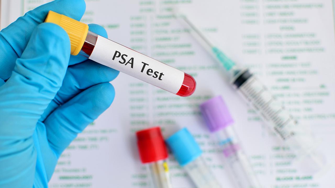PSA test