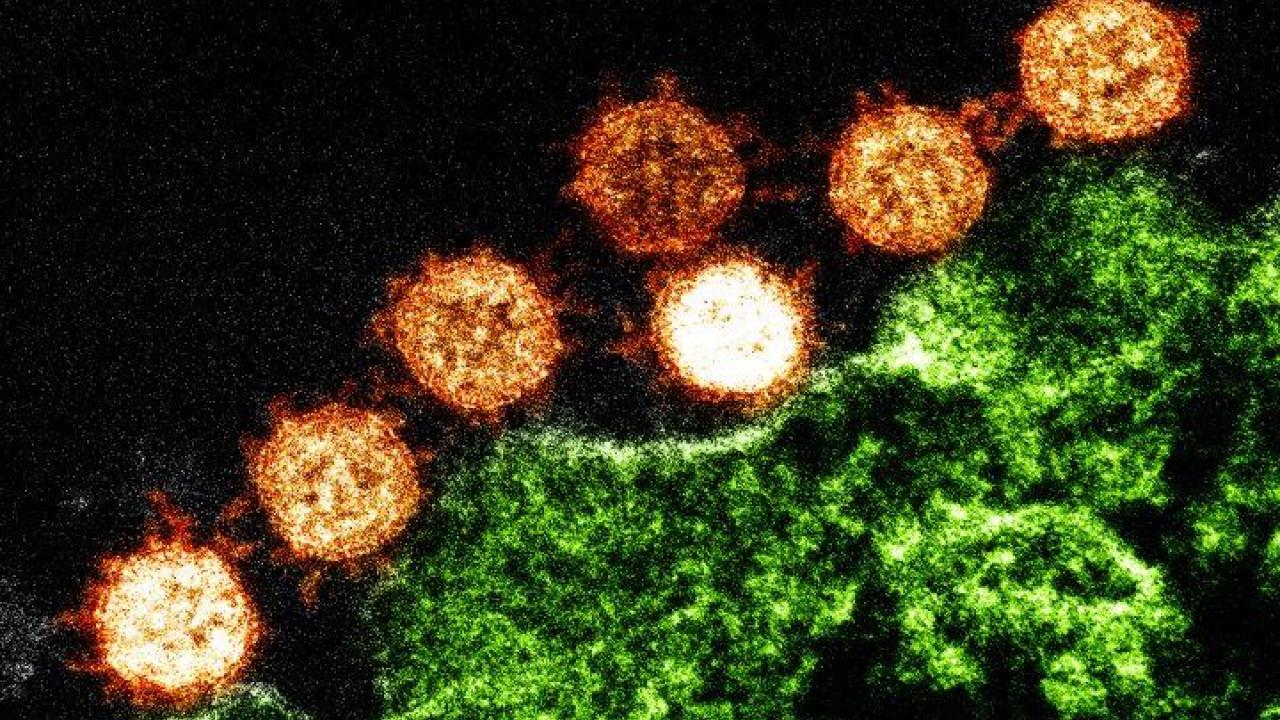 Corovirus Image by NIH