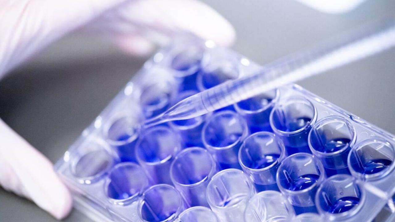 Gloved hands use a pipette to transfer liquid into a multiwell laboratory plate.