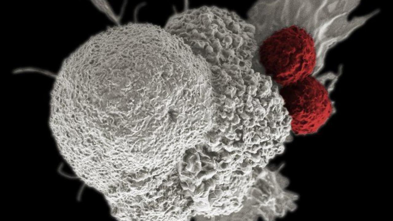 A scanning electron micrograph of an oral squamous cancer cell (white) being attacked by two cytotoxic T cells (red), part of a natural immune response. Image by NIH Immunotherapy