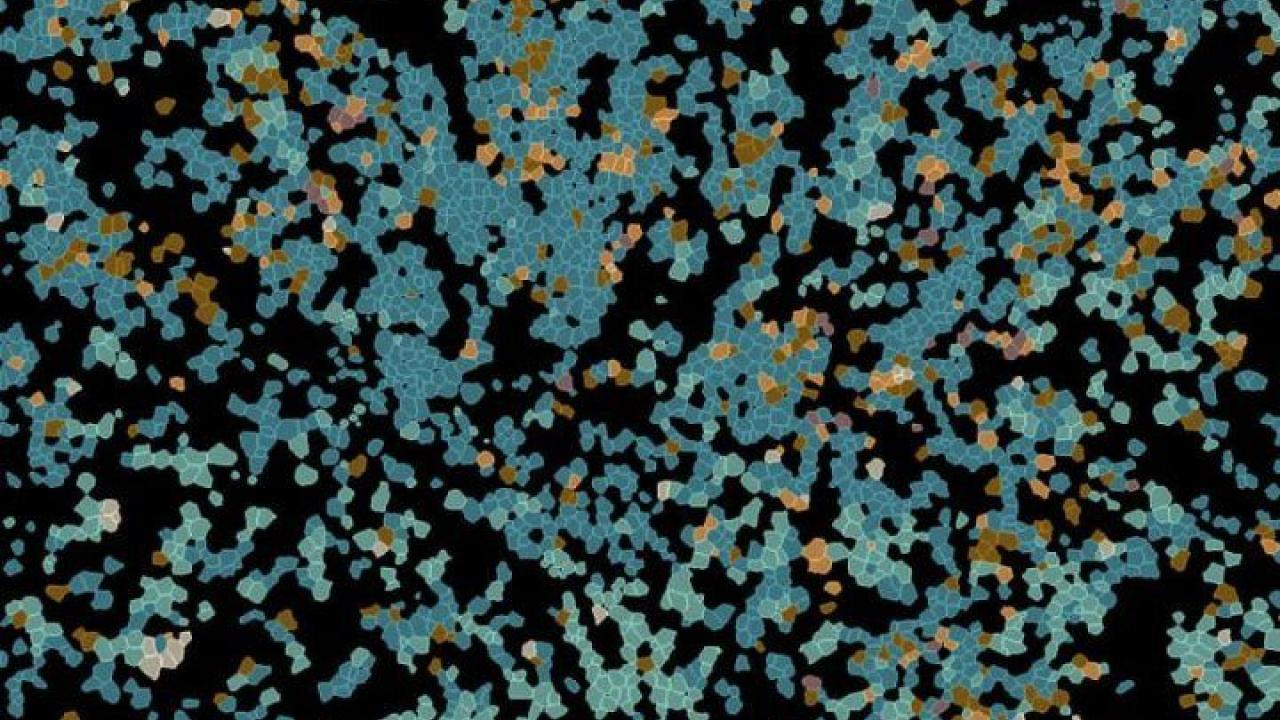 The authors used a new tissue imaging technique to identify each cell in the lymph node and to measure its activation and function. This image shows various types of immune cells in the lymph node, each colored based on its cell type. Image by Spitzer Lab Imaging of cells in lymp nodes. Cells are blue and tan, indicating a different cell type.