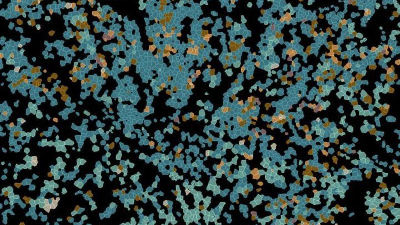 Cells in Lymph Node