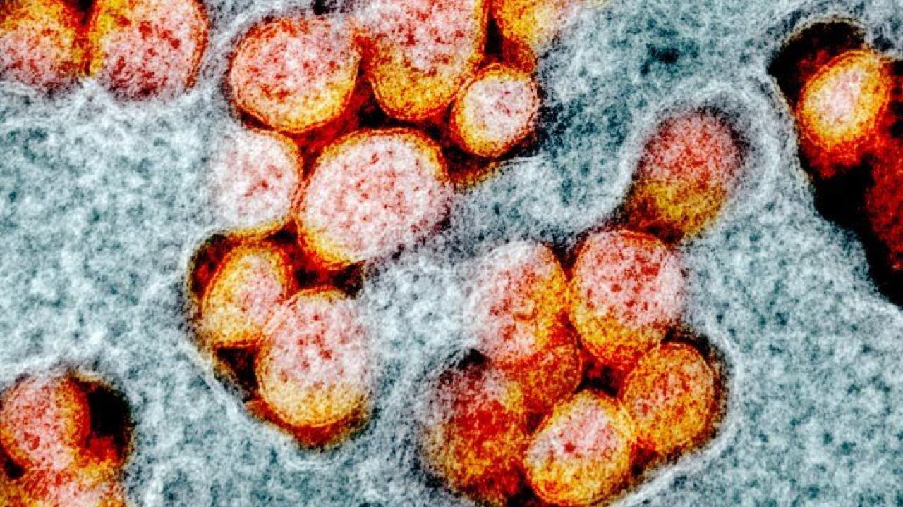Image credit: National Institute of Allergy and Infectious Diseases, NIH Image credit: National Institute of Allergy and Infectious Diseases, NIH