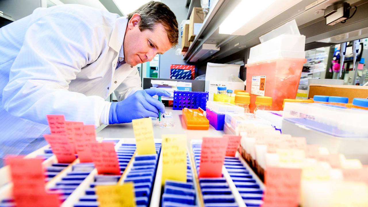 David Solomon, MD, extracts DNA from brain tumor tissue for genomic testing. Image by Noah Berger David Solomon, MD, extracts DNA from brain tumor tissue for genomic testing.