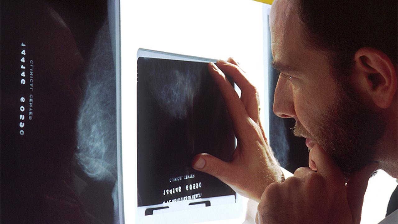 A doctor examines mammograms on a view box. Image courtesy the National Cancer Institute (NCI).