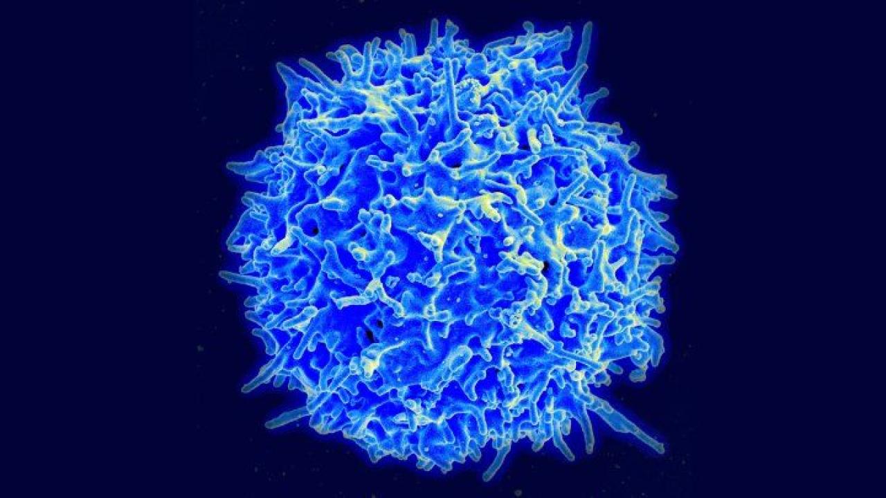 A human T cell. Image courtesy of NIH A human T cell. Image courtesy of NIH