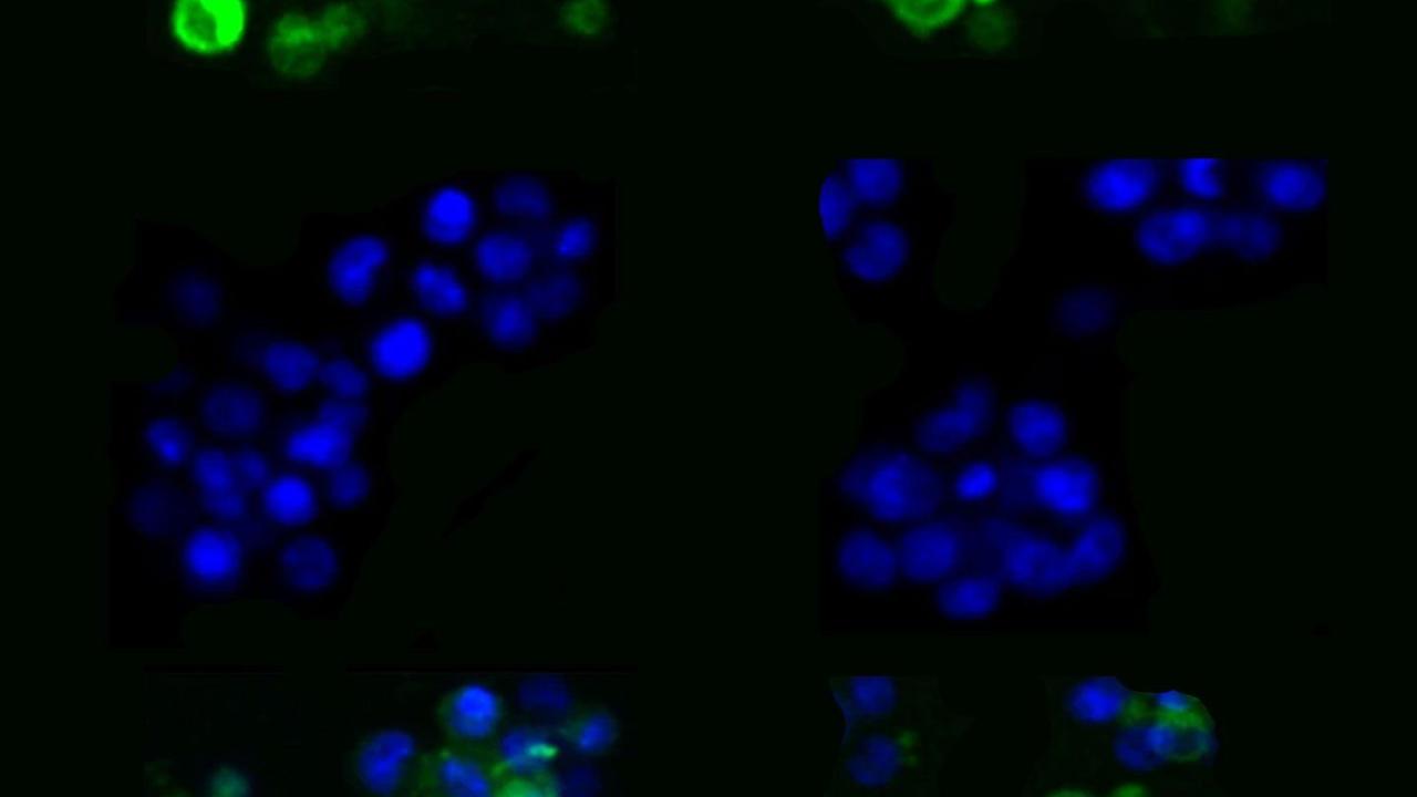 Microscopy of IL2RA gene