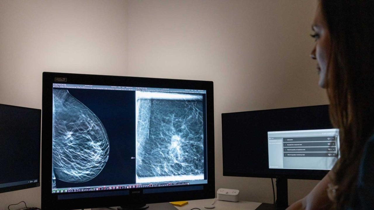 Image of Mammogram. Photo by Erin Lubin