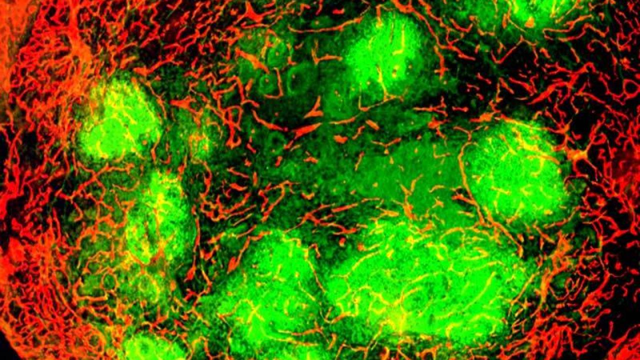 Tumor with green patches of vaccinia virus infection surrounded by red blood vessels. Image courtesy Donald McDonald.