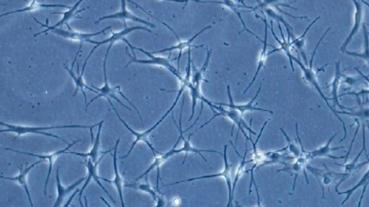 Melanoma arises in a type of skin cell called a melanocyte, seen here in a tissue culture. Image by Hunter Shain