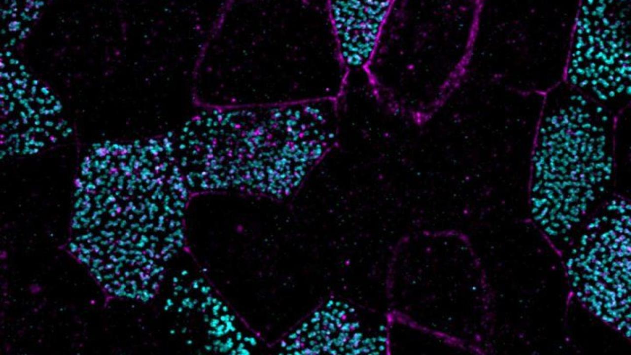 Centrioles (cyan) in lung cells. Cell boundaries are in magenta. Credit: Semil Choksi Centrioles (cyan) in lung cells. Cell boundaries are in magenta. Credit: Semil Choksi