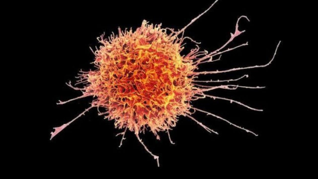 Colorized scanning electron micrograph of a natural killer cell from a human donor. Image by National Institutes of Allergy and Infectious Diseases Colorized scanning electron micrograph