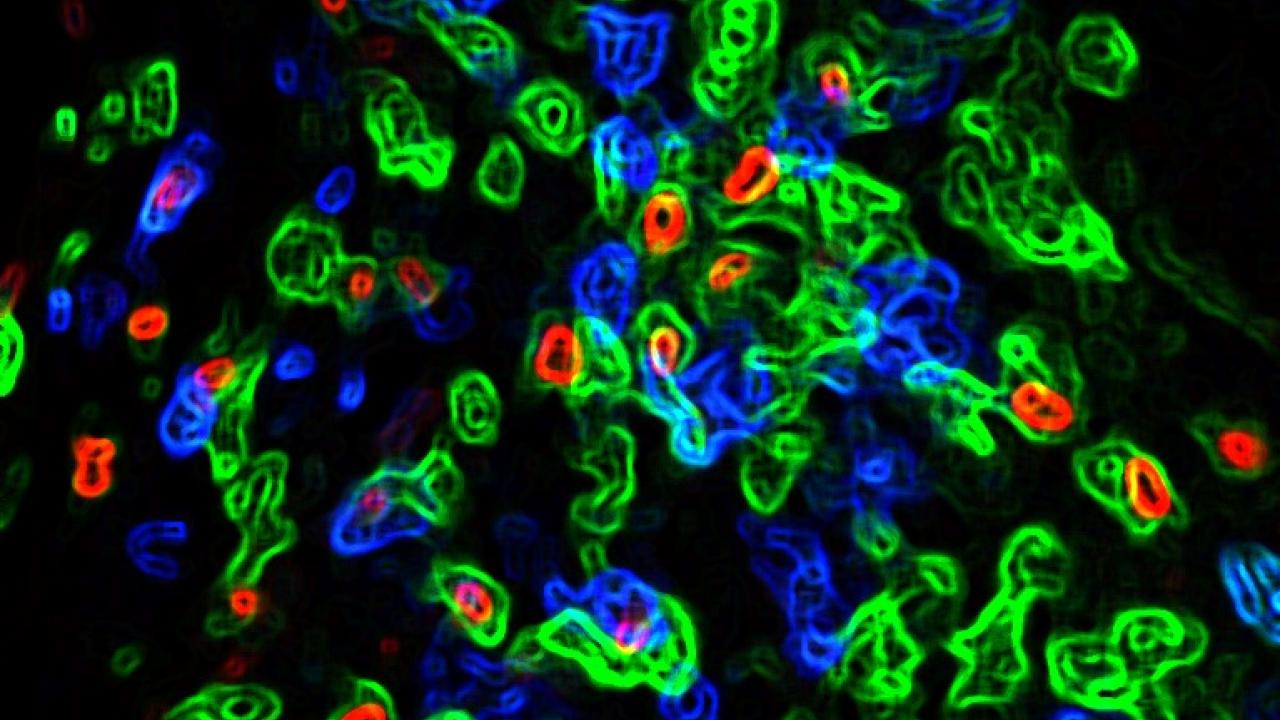 Artistic rendition of an immunofluorescent image of T cells in transplanted islets in mice. Image courtesy the Tang Lab, UCSF. Tang Lab UCSF