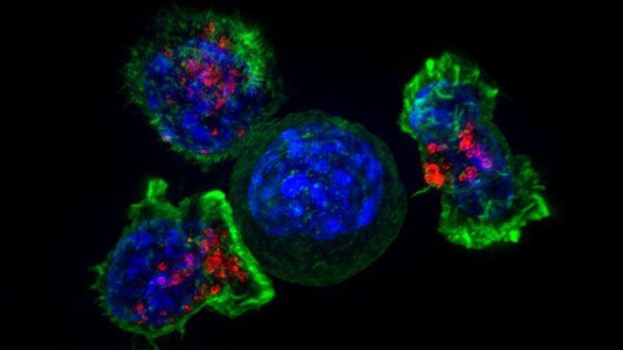 Microscopic image of a group of killer T cells (green and red) surrounding a cancer cell (blue, center). Image by Alex Ritter, Jennifer Lippincott Schwartz and Gillian Griffiths, National Institutes of Health Microscopic image of a group of killer T cells (green and red) surrounding a cancer cell (blue, center). Image by Alex Ritter, Jennifer Lippincott Schwartz and Gillian Griffiths, National Institutes of Health