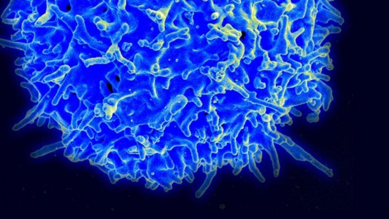 Scanning electron micrograph of a human T-cell from the immune system of a healthy donor. Image credit: National Institute of Allergy and Infectious Diseases (NIAID)