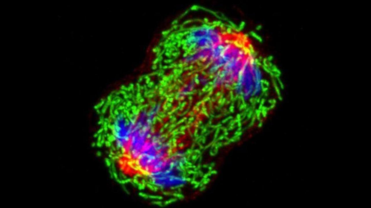 A triple-negative breast cancer cell in metaphase during cell division. Image by National Cancer Institute breast cancer cell