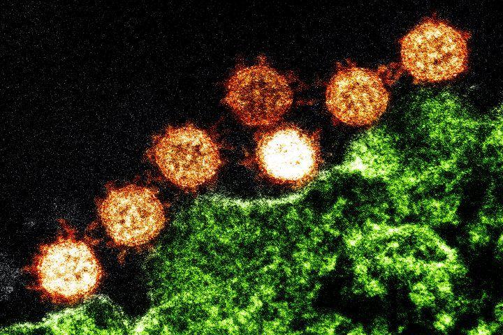 Coronavirus Image by NIH
