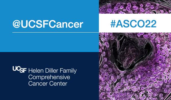 UCSF at ASCO 2022