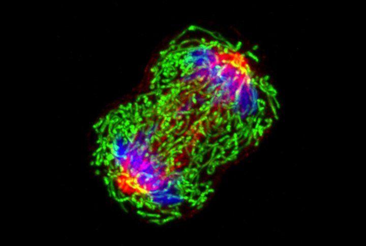 triple negative breast cancer cell