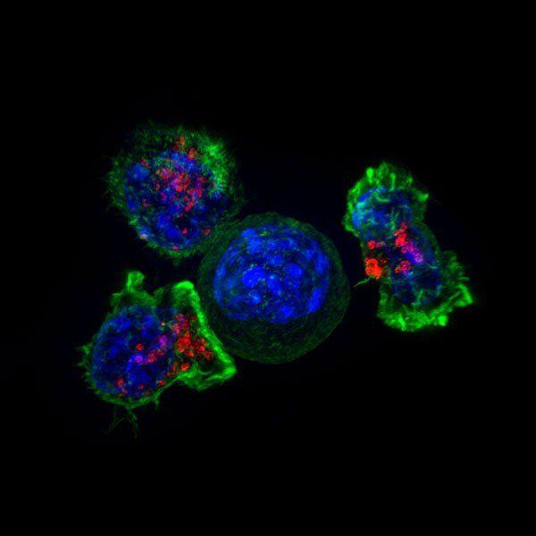 Microscopic image of a group of killer T cells (green and red) surrounding a cancer cell (blue, center). Image by Alex Ritter, Jennifer Lippincott Schwartz and Gillian Griffiths, National Institutes of Health