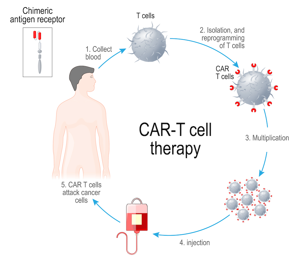 Cancer Immunotherapy Trials