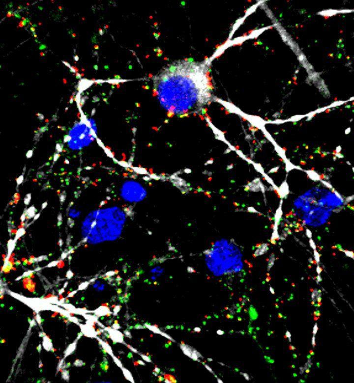 Glioblastoma Cell Connections