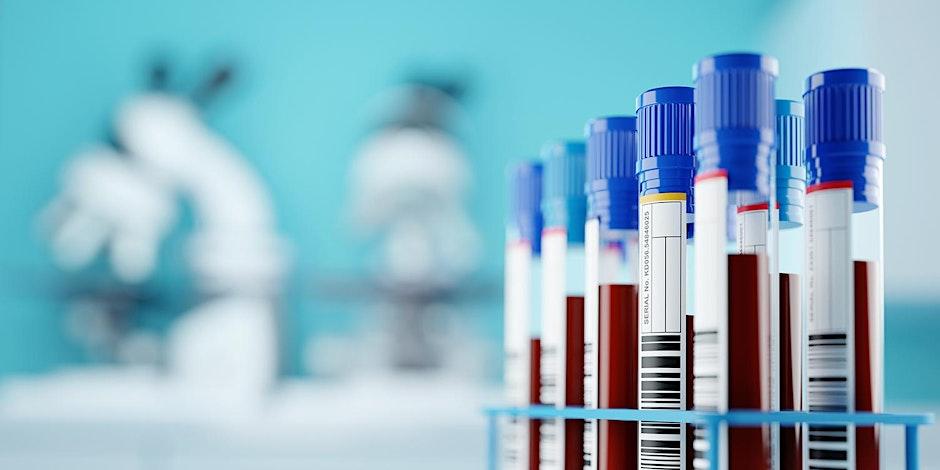 Blood samples in test tubes in a lab
