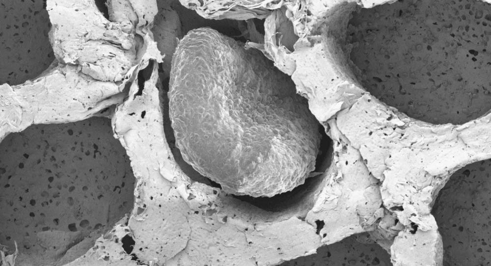 Electron microscopy of fat organoids that were implanted to out-compete tumors. Image by Ahituv Lab