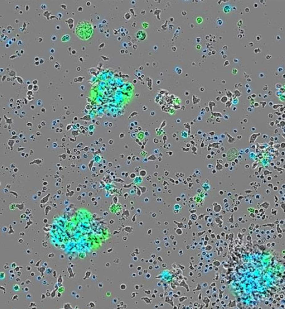A radioactive antibody accumulates on human tumor cells in mice, thanks to SRC, a protein that is accidentally shunted to the cell surface in cancer.
