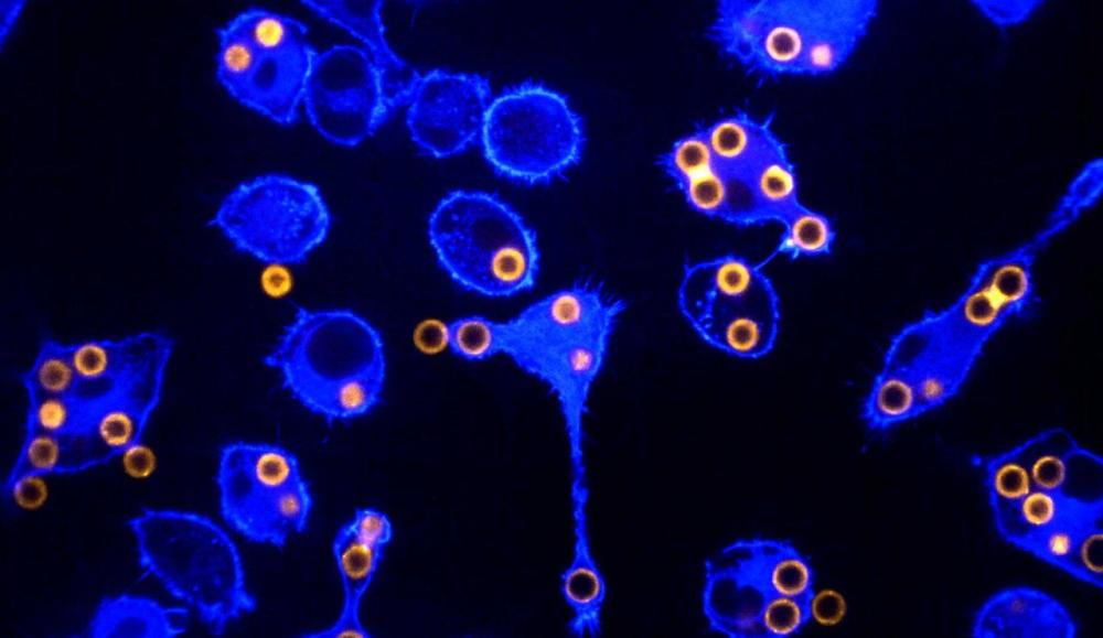 Macrophages (blue) were engineered with a chimeric antigen receptor (CAR), enabling them to eat beads (orange) that were coated with a tumor protein. Roarke Kamber, PhD, is engineering these “big eater” immune cells to fight cancer. Image by Thanos Syntrivanis, Kamber Lab