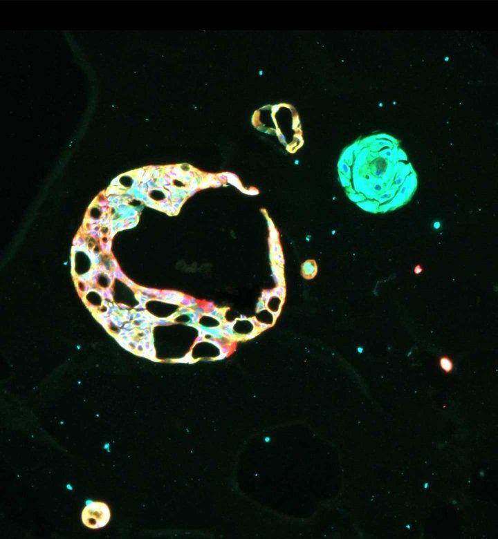 Microscopic image showing breast cancer organoids.