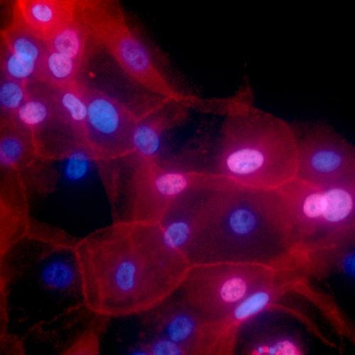 Breast Cancer Cells