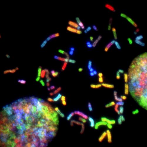 Chromosomes from glioblastoma cells