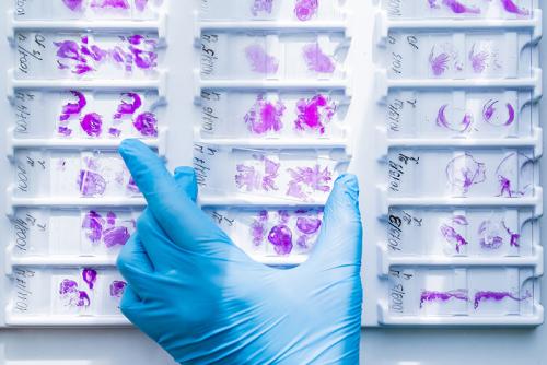 Hand in blue glove holding glass histology slides 