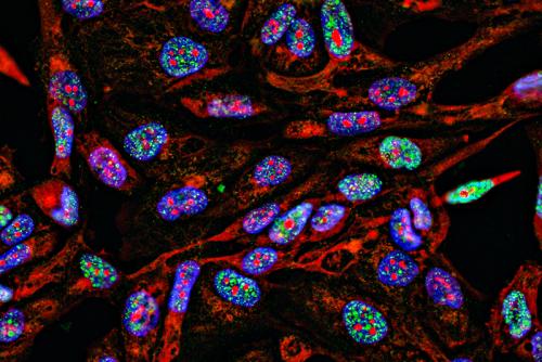 Fluorescent Imaging immunofluorescence of cancer cells growing in 2D with nuclei in blue, cytoplasm in red and DNA damage foci in green 