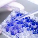 closeup of pipette with samples of cancer cells that have been dyed purple