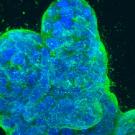 Genetic cell therapy image