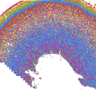 Human brain cells, classified into different groups according to gene expression (each color represents a group), are mapped back to their original locations in the human brain. A detailed analysis of brain cell gene expression over time revealed the genetic origins of autism and glioblastoma at young ages. Image by Li Wang and Songcang Chen/Kriegstein Laboratory